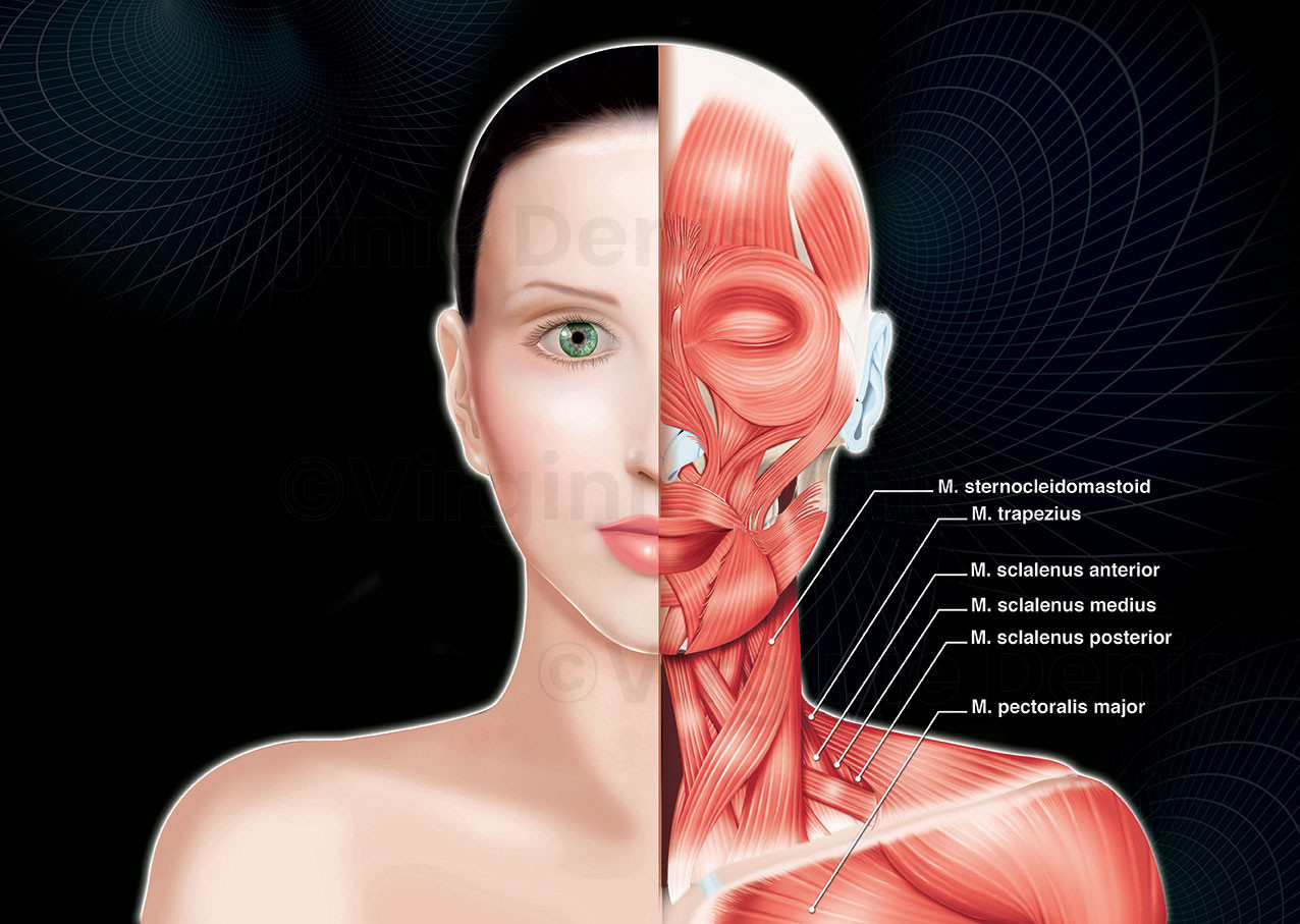 Cervical dystonia, muscles superficiels de la face et du cou