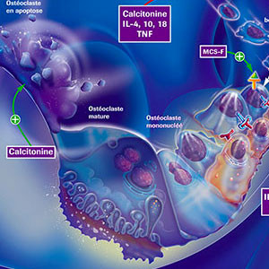 Poster De l’os normal à l’os pathologique