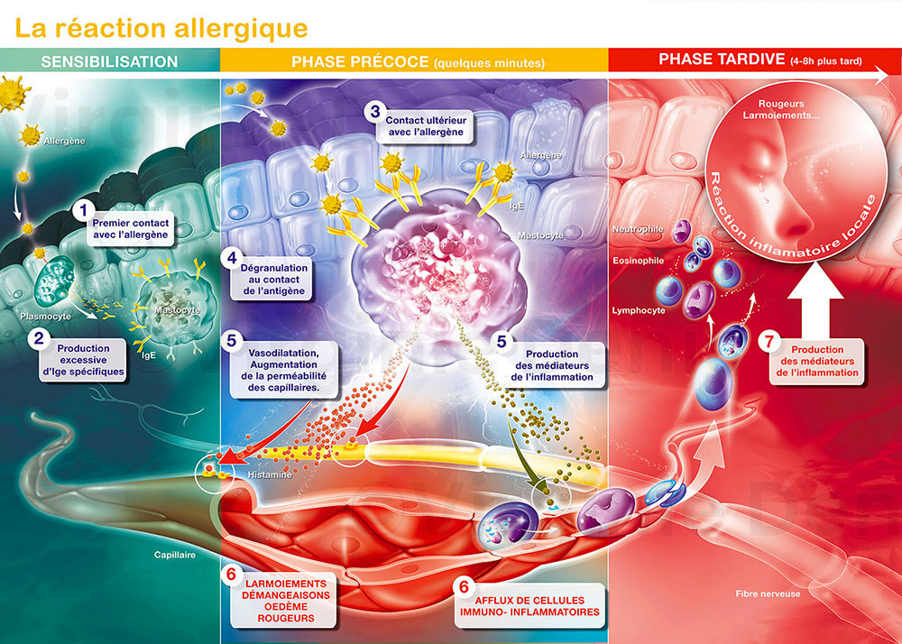 La réaction allergique - Illustration médicale