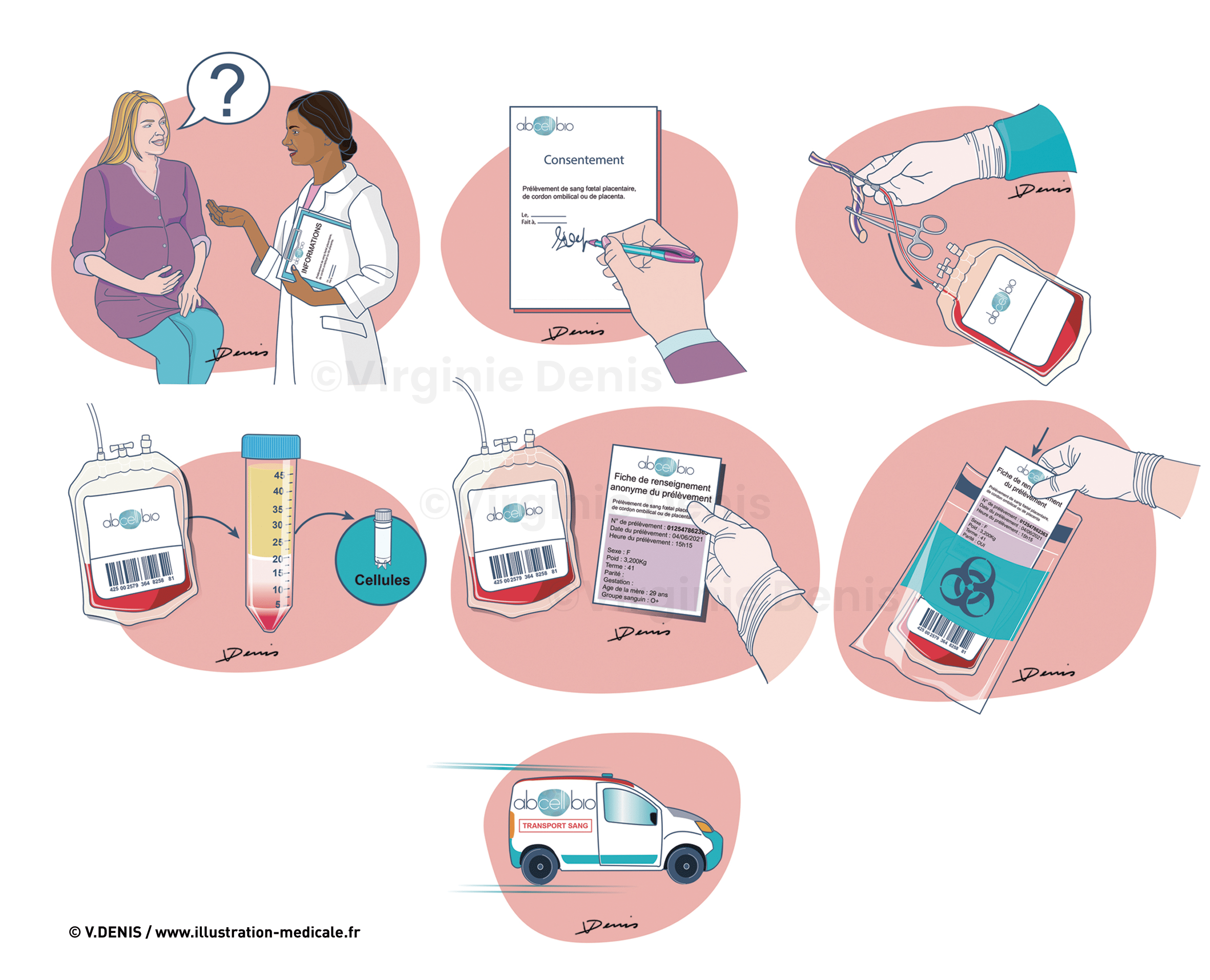 Parcours prélèvement du sang fœtal placentaire, de cordon ombilical ou de placenta