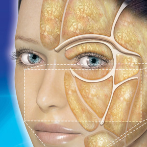 Chirurgie esthétique : compartiments graisseux de la face, relâchement des ligaments