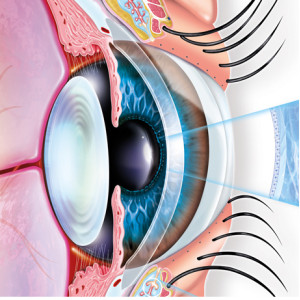 Coupe sagittale de la sphère oculo-palpébrale