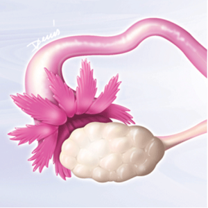 Utérus normal / Utérus ménopausé