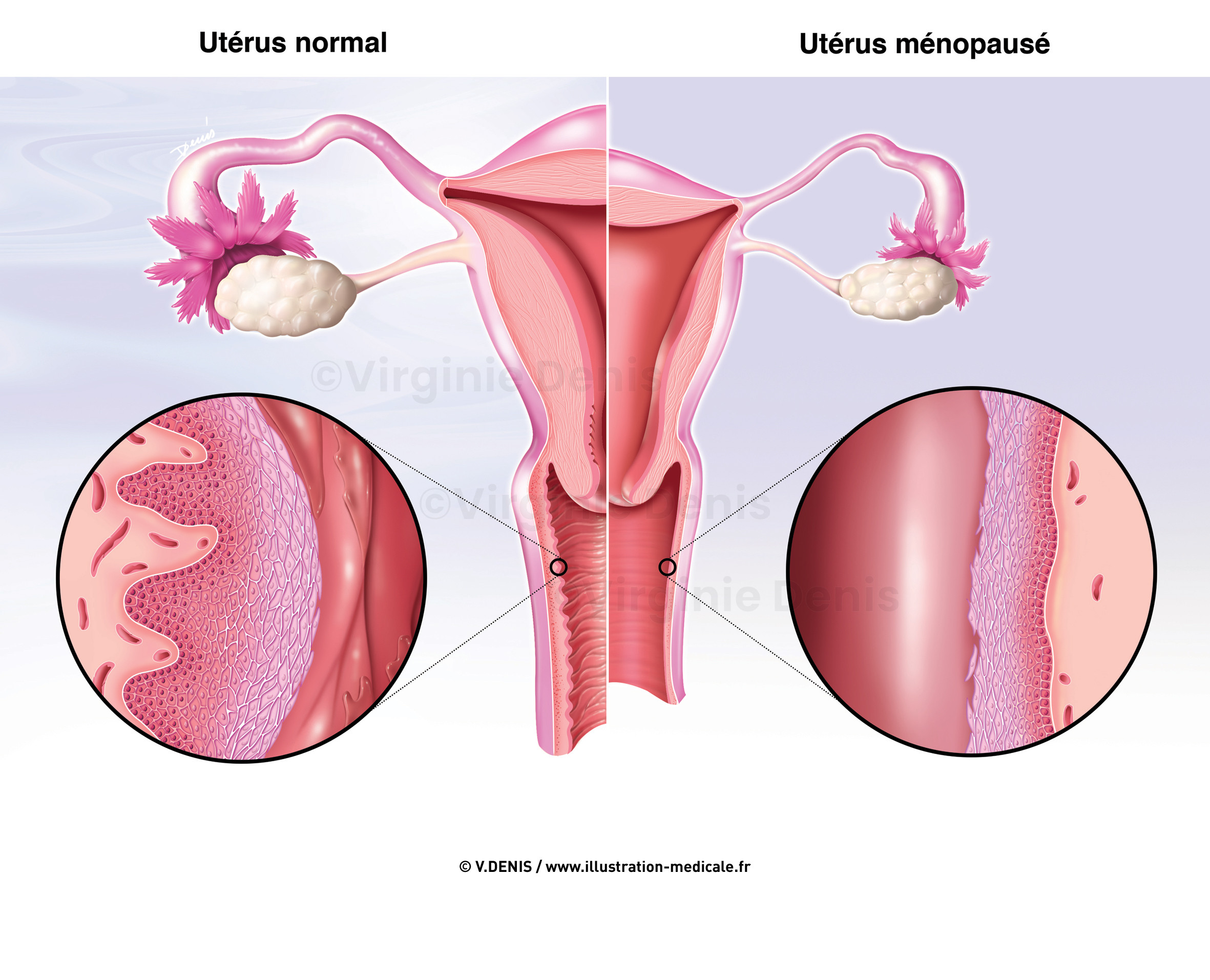 illustration-medicale-new55