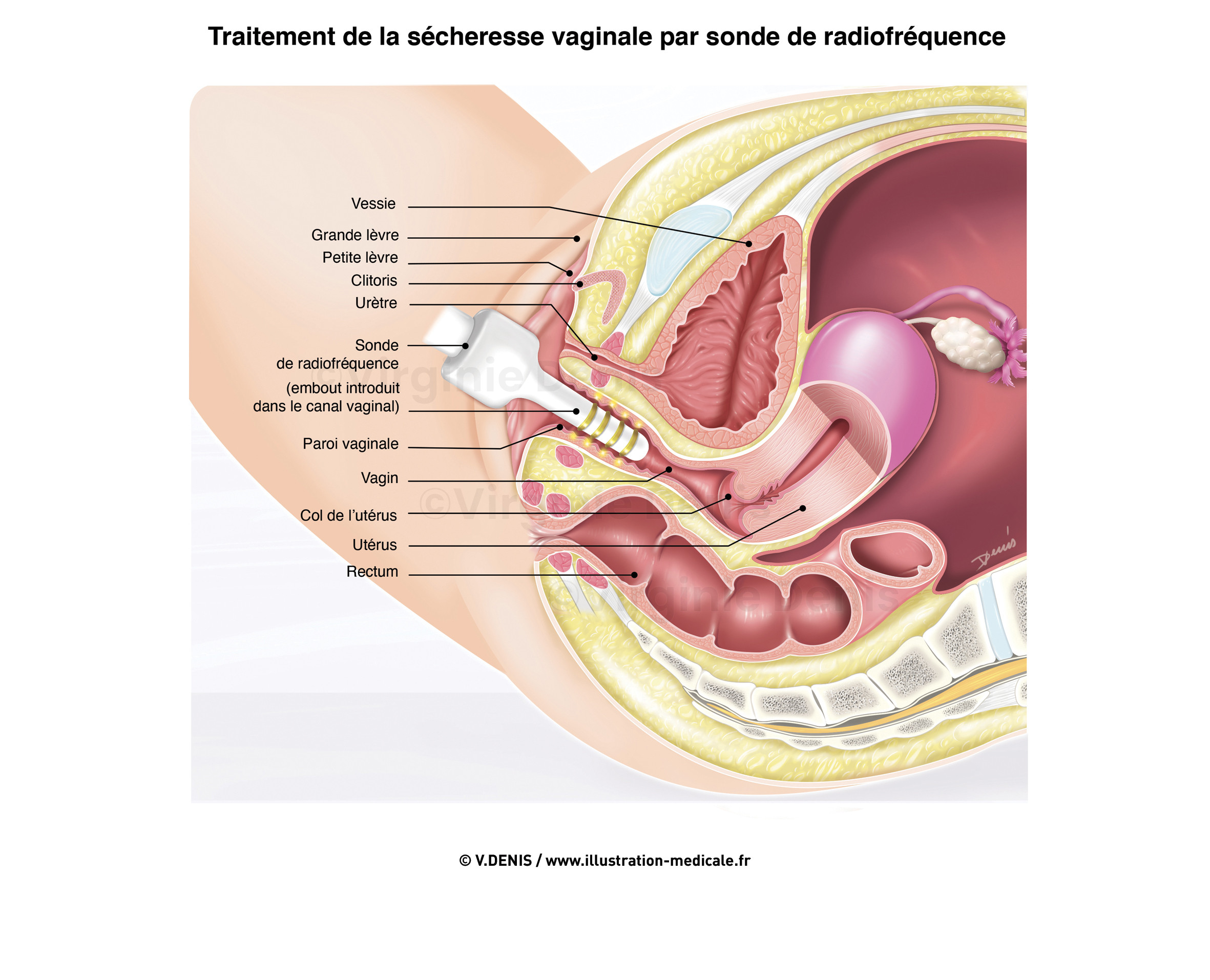 illustration-medicale-new89
