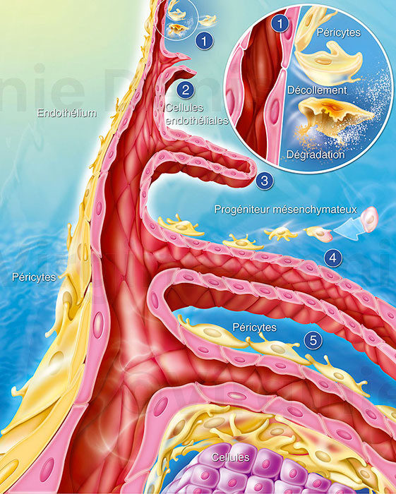 Angiogenese - Illustration médicale