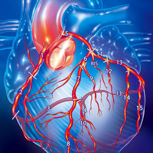 Poster échocardiographie du cœur